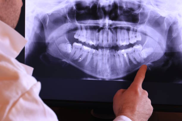 Best Broken or Cracked Tooth Emergency Dentist in Russell, PA